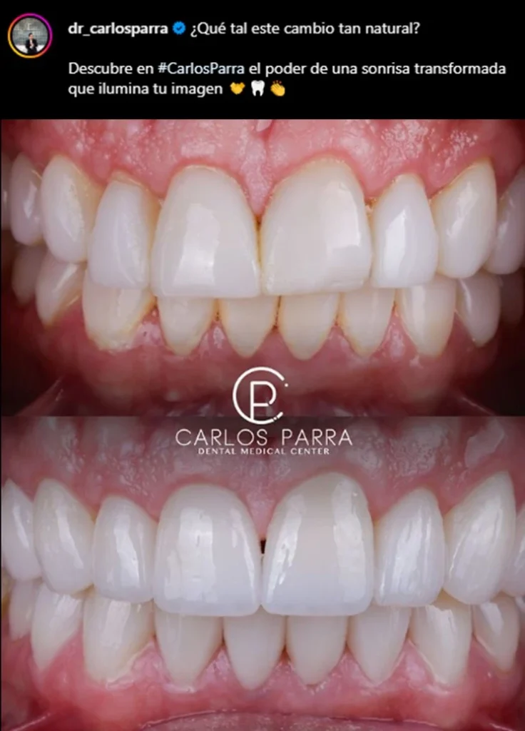 Instagram @dr_carlosparra
